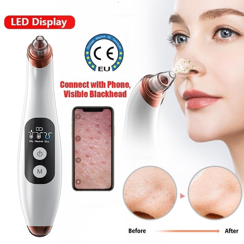 Visual Blackhead Remover Facial Cleaner Nose Deep Pore Remover Acne Pimple Removal Vacuum Suction Image 1