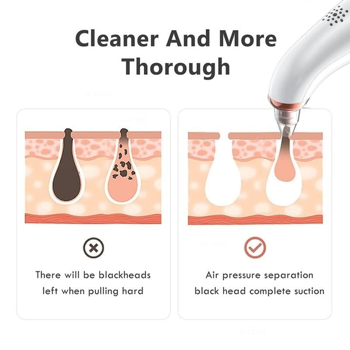 Visual Blackhead Remover Facial Cleaner Nose Deep Pore Remover Acne Pimple Removal Vacuum Suction Image 4