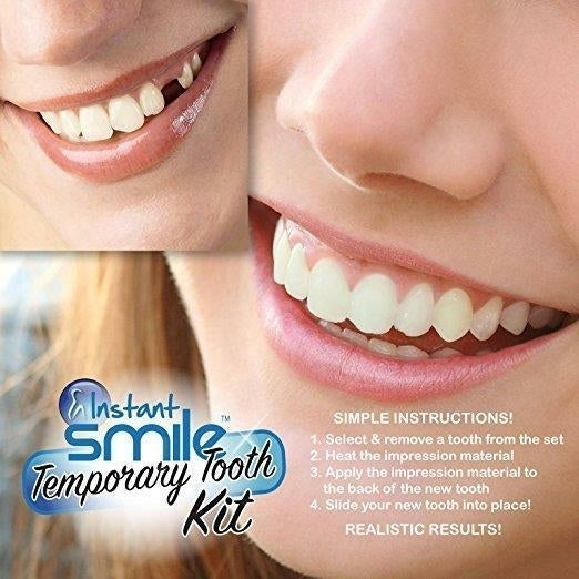 MULTI SHADE TOOTH REPLACEMENT KIT W 2 PKGS EX BEADS easy replace missing tooth Image 1