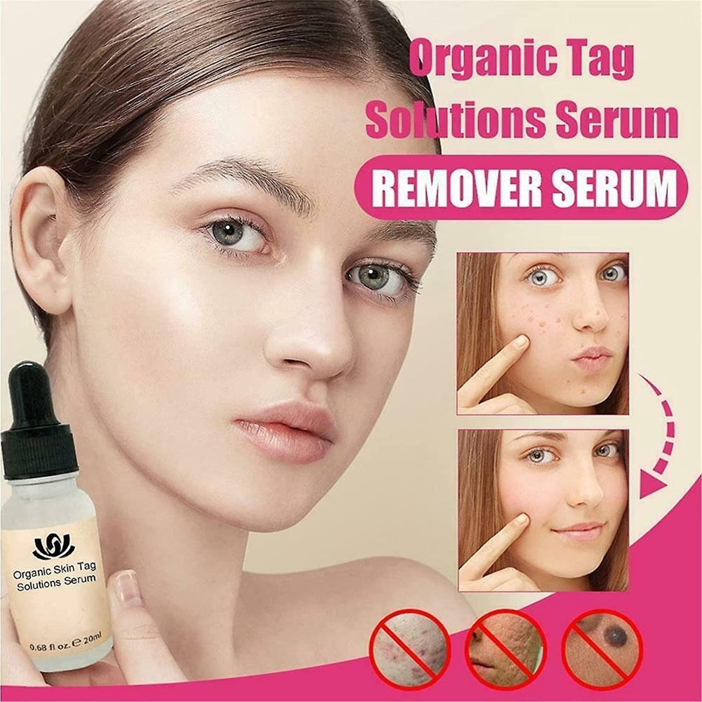2pcs Organic Tags Solutions Serum Spot Purifying Serum Mole Remover Repair Cream Oil Image 2