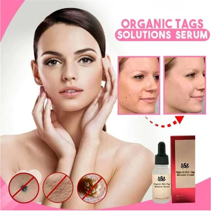 2pcs Organic Tags Solutions Serum Spot Purifying Serum Mole Remover Repair Cream Oil Image 3