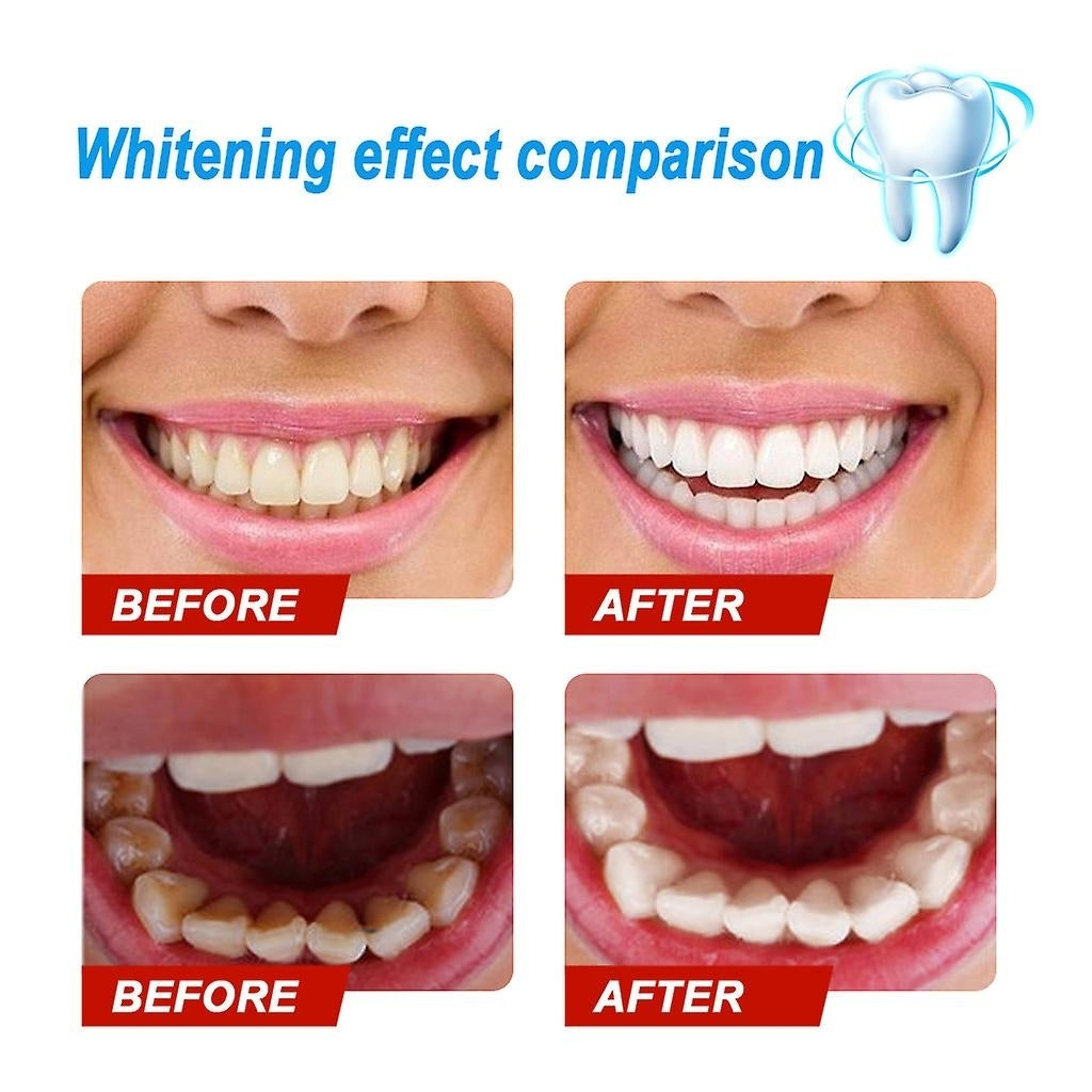 Baking Soda Toothpaste Stain Removal Whitening Toothpaste Fight Bleeding Gums Image 3