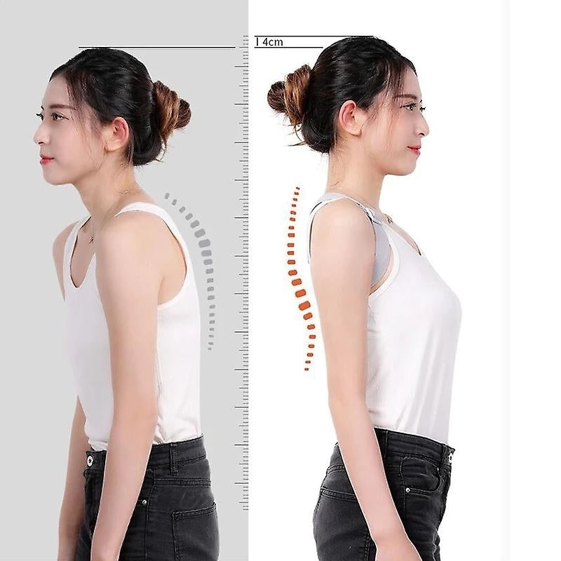 Smart Back Posture Corrector Humpback Correction Belt Vibration Posture Training Tool Image 2