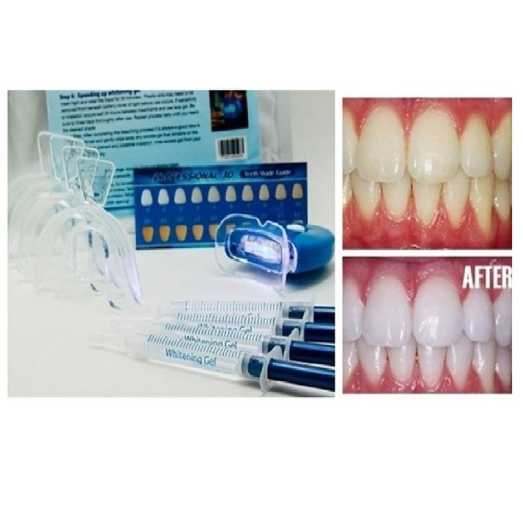 Home Teeth Whitening 3D System and Free Remineralization Gel Image 1